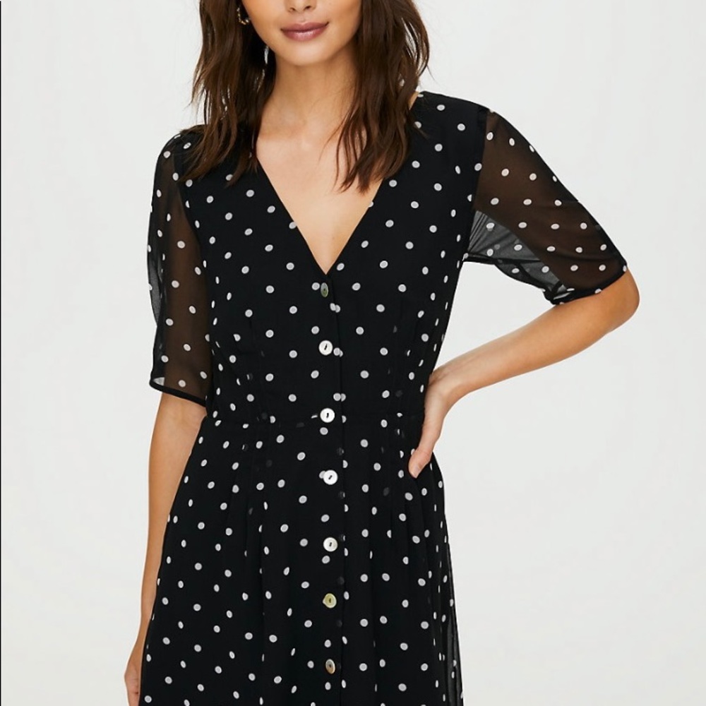 Aritzia Button Front Dress